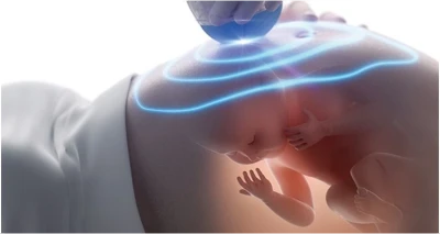 4D ultrazvuk i DVD snimka Vaše bebe!