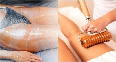 5 udarnih  tretmana protiv celulita u kombinaciji sa mederoterapijom!