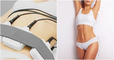 6 tretmana mršavljenja i uklanjanja celulita u kombinaciji sa limfnom drenažom i elektrostimulacijom!