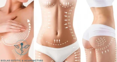 HIFU, BODYFORMER I LIPOLASER!