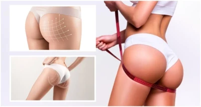 BRAZIL GLOW – fokus stražnjice, paket oblikuje i podiže stražnjicu, zaglađuje kožu i smanjuje celulit, pružajući savršeno definiran i blistav izgled tijela!