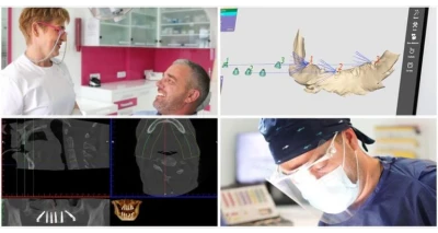 CBCT 3D snimka kompletne gornje i donje čeljusti uz detaljnu analizu snimke, besplatan dentalni pregled i konzultacije - uklonite sumnje na određene bolesti usne šupljine