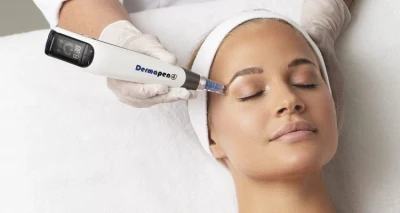 Dermapen i ultrazvučno čišćenje lica!