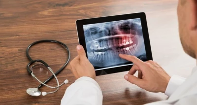 Digitalni ortopan - kvalitetna i čista snimka cijele čeljusti u Ordinaciji dentalne medicine Čeko!