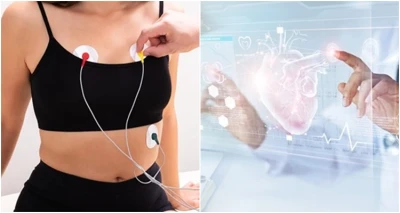 Holter EKG-a s očitanjem - 24-satno mjerenje uz analizu podataka i očitanje nalaza!