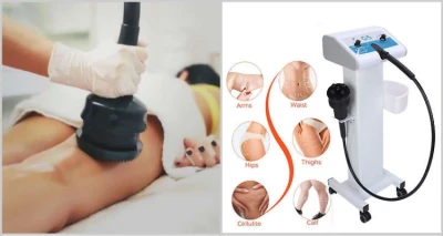 24 Body Shape tretmana!