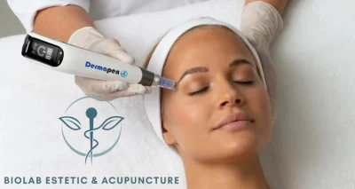 Mesoterapija dermapenom - 1 tretman lica + odgovarajući meso-koktel!