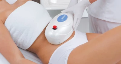 5 tretmana cryolipolize tijelo