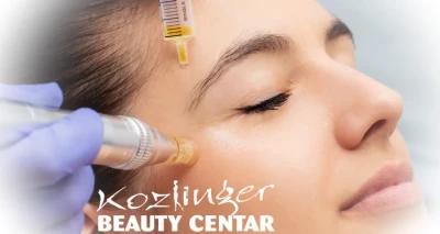 Revolucionarni lifting lica Plasma Penom!