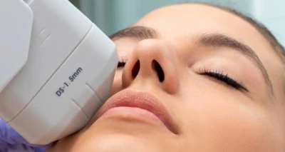 [RIJEKA] HIFU tretman lica i vrata!