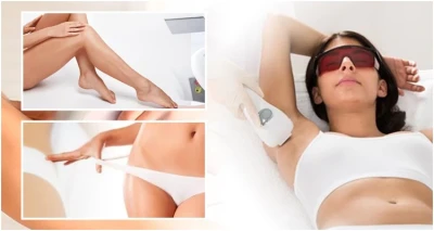 Trajno uklanjanje dlačica diodnim laserom - brazilska epilacija / epilacija cijelih nogu + brazilka ili epilacija cijelog tijela!