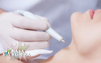 Iskoristite priliku za sigurno i profesionalno uklanjanje bradavica i kondiloma uz pomoć iskusnog medicinskog osoblja Naše klinike!