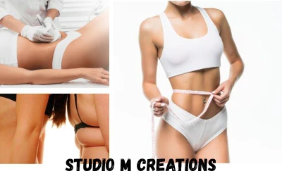 Profesionalni tretman oblikovanja tijela – kriolipoliza jedne regije sa dvije sonde u Studiju M Creations!