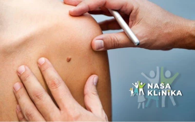 Ne zanemarujte promjene na koži I Obavite stručan pregled i spriječite moguće komplikacije u Našoj klinici!