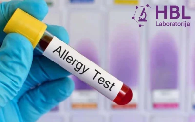 Obavite alergotest na inhalatorne ili nutritivne alergene u HBL laboratoriji i riješite se alergijskih reakcija na vrijeme!