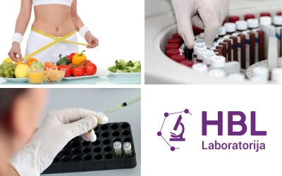 Obavite test intolerancije na hranu uz analizu holesterola, KKS, triglicerida, glukoze i željeza u serumu te na taj način unaprijedite kvalitet Vašeg zdravlja u HBL Laboratoriji!