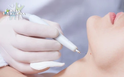 Naša klinika | Uklanjanje bradavica i kondiloma na bezbjedan i efikasan način uz iskustvo, preciznost i vrhunsku medicinsku njegu!