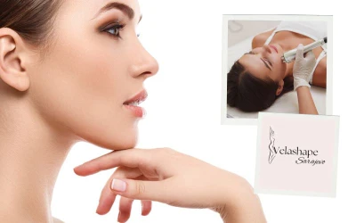 Radiofrekvencija lica u Velashape salonu – prirodno zatezanje i revitalizacija kože lica!