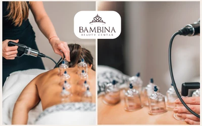 Fantastična ponuda tretmana hidžame kojom ćete se osloboditi nakupljenih toksina i unaprijediti zdravlje Vašeg organizma u Bambina Beauty Centru!