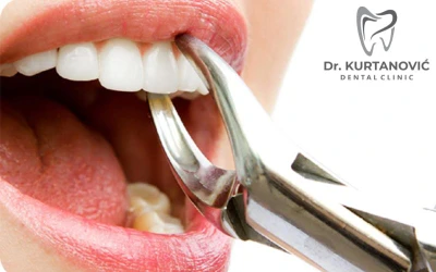 Ne odgađajte posjetu stomatologu i priuštite sebi lijep osmijeh i zdrave zube u Stomatološkoj ordinaciji Dr. Kurtanović Dental Clinic!