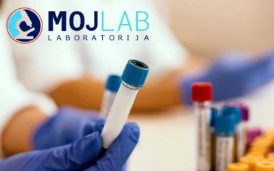 Privatni medicinsko-biohemijski laboratorij MOJ LAB – paket za muškarce za provjeru zdravlja koji uključuje internističku analizu i tumorske markere za prostatu!
