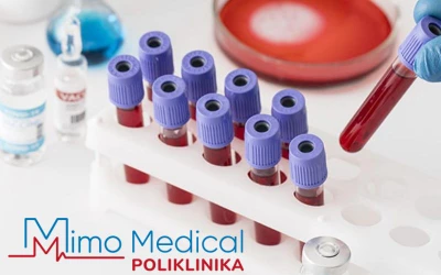 Poliklinika Mimo Medical | Djelujte preventivno uz zdravstveni paket analiza za provjeru općeg zdravstvenog stanja!