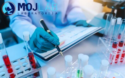 Privatni medicinsko-biohemijski laboratorij MOJ LAB – internistički paket i polni hormoni za laboratorijsku analizu i procjenu zdravstvenog stanja i hormonskog balansa!