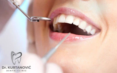 Usluge popravka zuba koje vraćaju povjerenje u Vaš osmijeh u Stomatološkoj ordinaciji Dr. Kurtanović Dental Clinic!