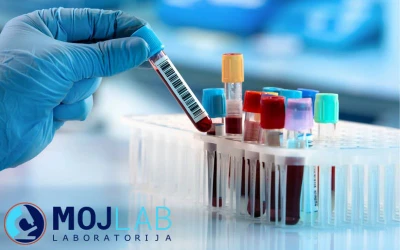 Privatni medicinsko-biohemijski laboratorij MOJ LAB – Internistički paket sa hormonima štitne žlijezde za detaljnu laboratorijsku analizu i praćenje funkcije!