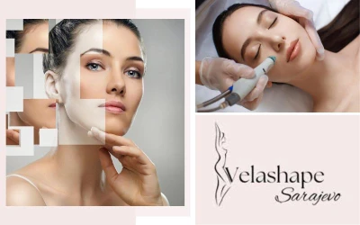 Kompletna njega lica kroz Hydrafacial tretman i mezoterapiju za dubinsku hidrataciju i podmlađen izgled u Velashape Salonu!