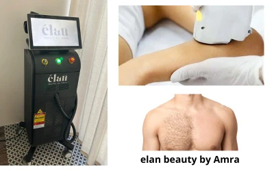 Revolucija u uklanjanju dlaka I Dugotrajna glatkoća s laserskom epilacijom u Elan Beauty by Amra!