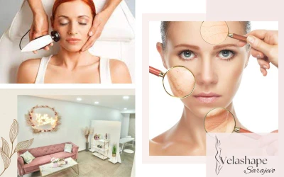 Doživite savršen spoj dubinskog čišćenja i lifting efekta uz Hydrafacijal tretman i radiofrekvenciju za svjež i blistav ten u Velashape Salonu!